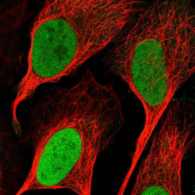 RNMT Antibody in Immunocytochemistry (ICC/IF)