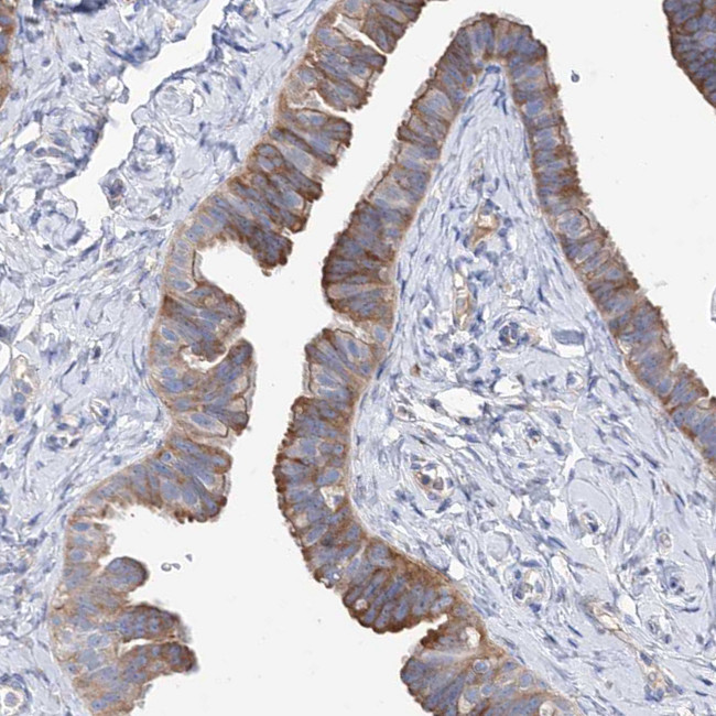 BBS4 Antibody in Immunohistochemistry (Paraffin) (IHC (P))