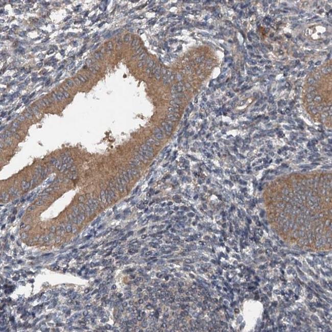 N4BP2L2 Antibody in Immunohistochemistry (IHC)