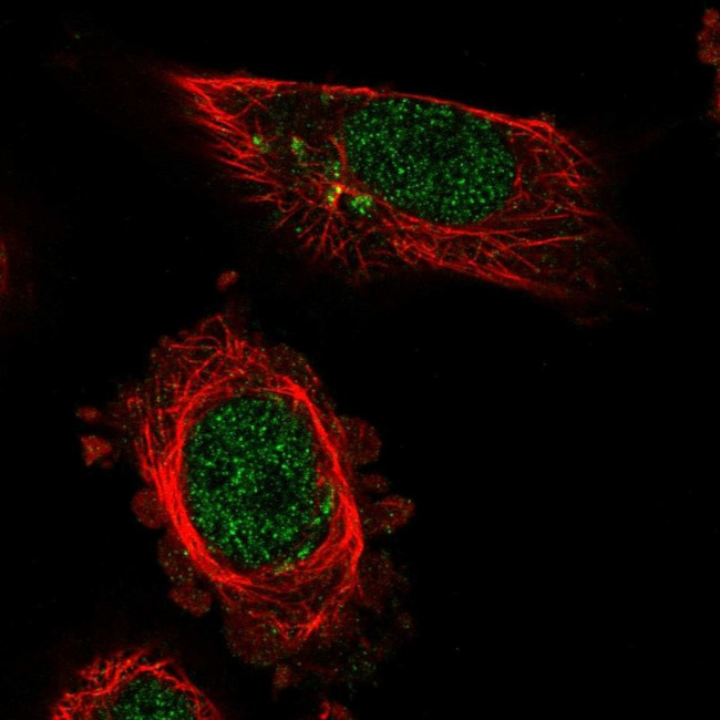 MED13L Antibody in Immunocytochemistry (ICC/IF)