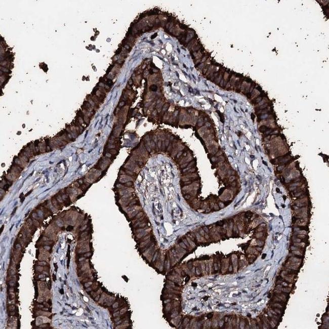 OGFOD2 Antibody in Immunohistochemistry (IHC)