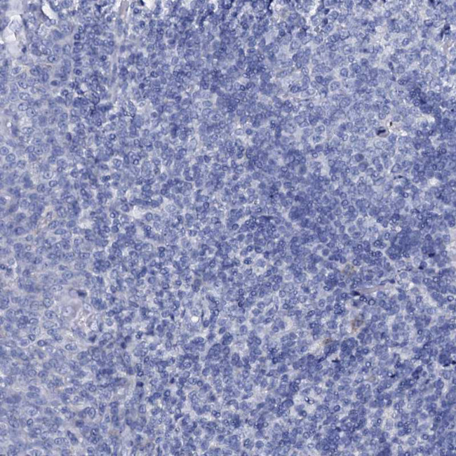 AMER2 Antibody in Immunohistochemistry (Paraffin) (IHC (P))