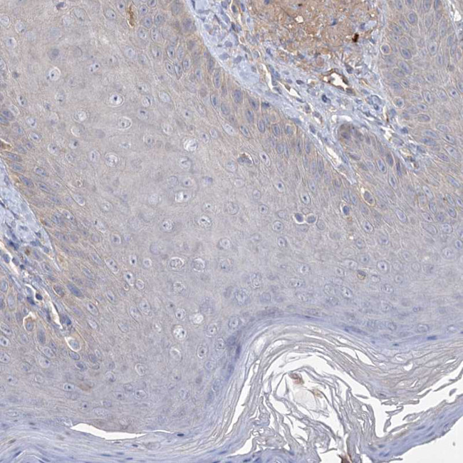 USP50 Antibody in Immunohistochemistry (Paraffin) (IHC (P))