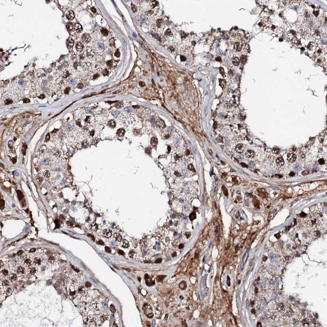 KIF18A Antibody in Immunohistochemistry (Paraffin) (IHC (P))