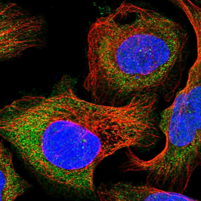 DAK Antibody in Immunocytochemistry (ICC/IF)