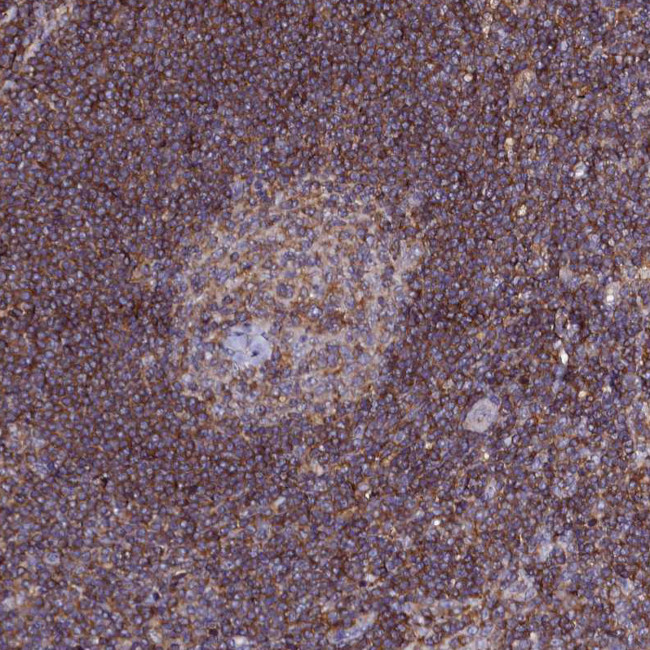 NCKAP1L Antibody in Immunohistochemistry (Paraffin) (IHC (P))