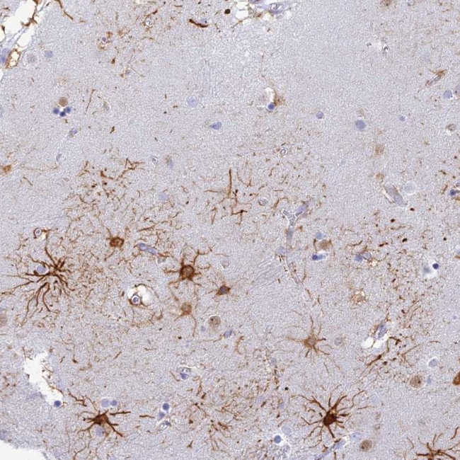 C12orf11 Antibody in Immunohistochemistry (Paraffin) (IHC (P))