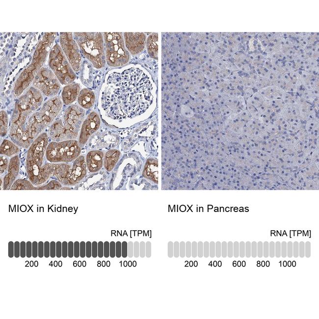 MIOX Antibody in Immunohistochemistry (IHC)