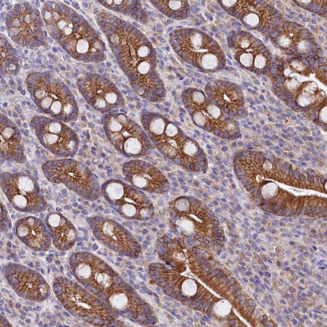 SACM1L Antibody in Immunohistochemistry (Paraffin) (IHC (P))