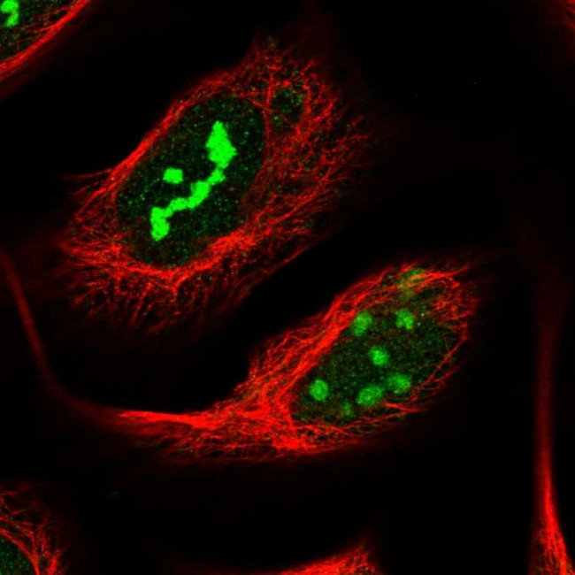 NOP14 Antibody in Immunocytochemistry (ICC/IF)