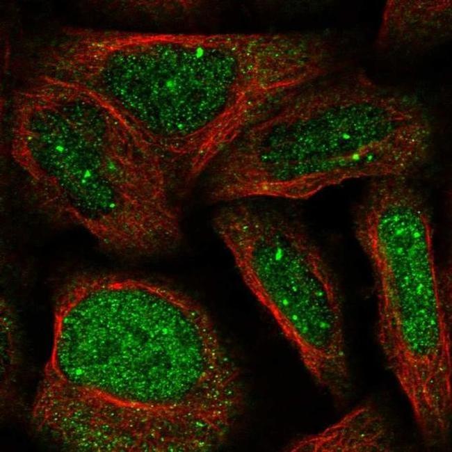 WDR19 Antibody in Immunocytochemistry (ICC/IF)