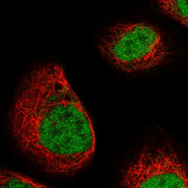 DCPS Antibody in Immunocytochemistry (ICC/IF)