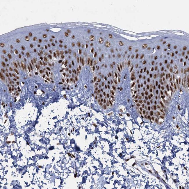 RPUSD4 Antibody in Immunohistochemistry (IHC)