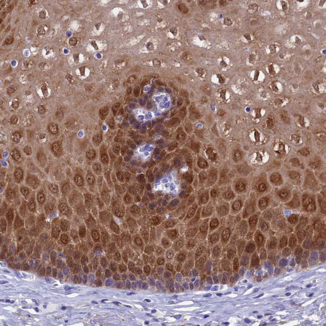 ADH7 Antibody in Immunohistochemistry (Paraffin) (IHC (P))