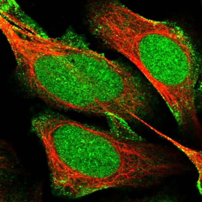 MPP8 Antibody in Immunocytochemistry (ICC/IF)