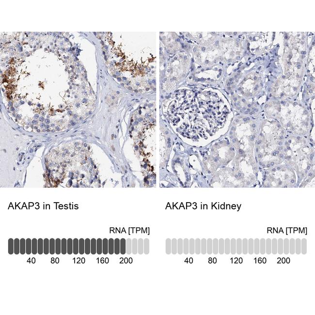 AKAP3 Antibody in Immunohistochemistry (IHC)