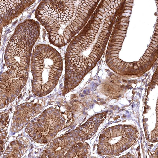 SVIP Antibody in Immunohistochemistry (Paraffin) (IHC (P))