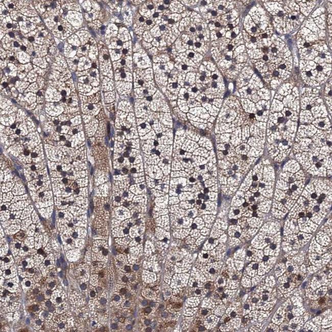 TRMT112 Antibody in Immunohistochemistry (IHC)