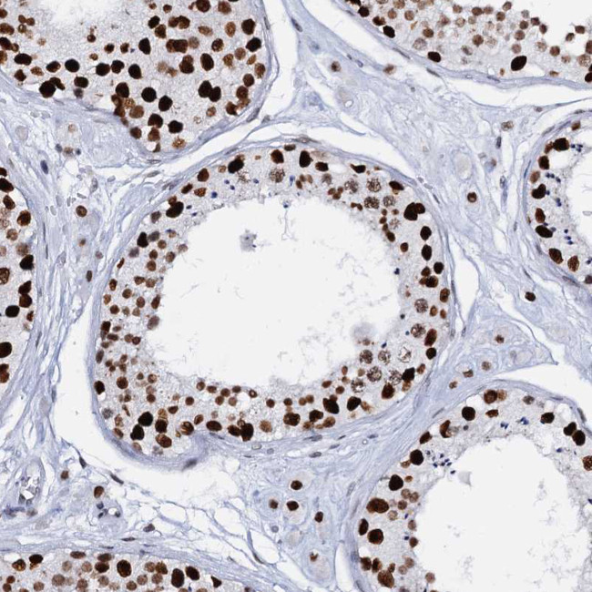 CMAS Antibody in Immunohistochemistry (Paraffin) (IHC (P))