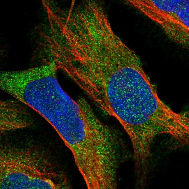 BCDIN3D Antibody in Immunocytochemistry (ICC/IF)