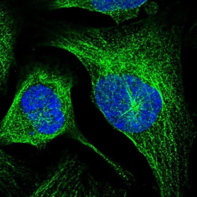 LRTOMT Antibody in Immunocytochemistry (ICC/IF)