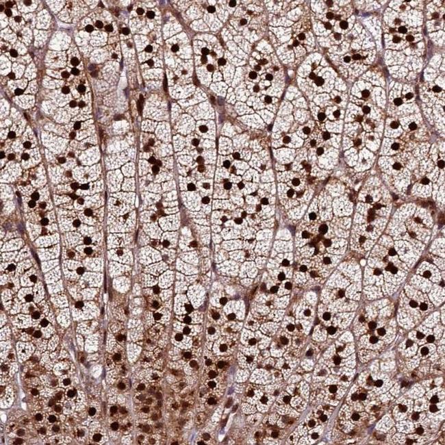 TRMT112 Antibody in Immunohistochemistry (IHC)