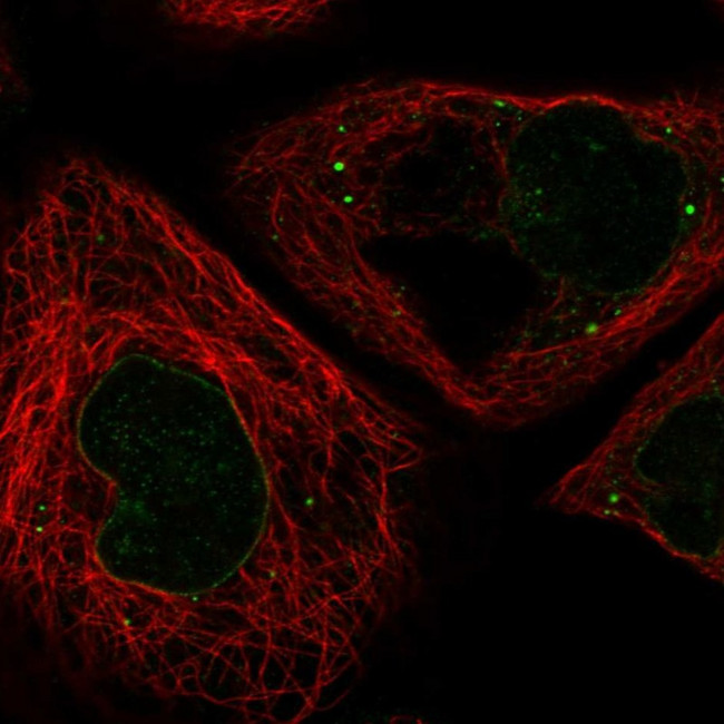 RNF6 Antibody in Immunocytochemistry (ICC/IF)