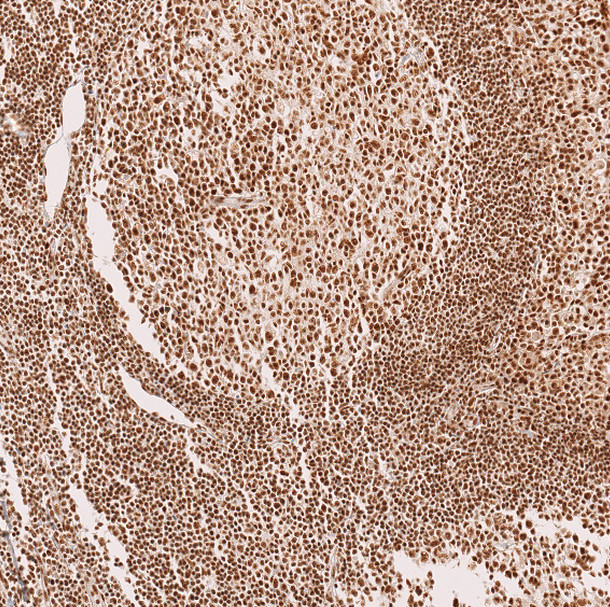 METTL4 Antibody in Immunohistochemistry (Paraffin) (IHC (P))