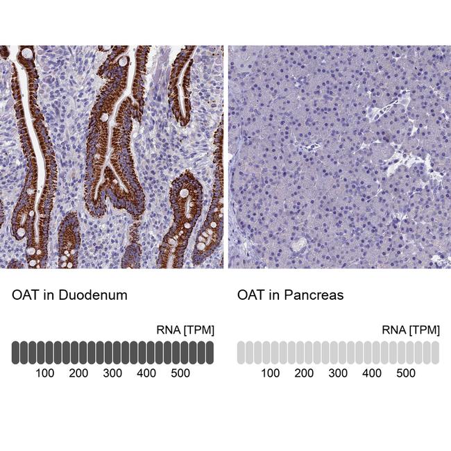 OAT Antibody in Immunohistochemistry (IHC)