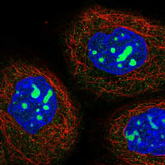 NOP2 Antibody in Immunocytochemistry (ICC/IF)