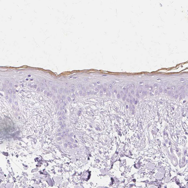 TGM1 Antibody in Immunohistochemistry (Paraffin) (IHC (P))