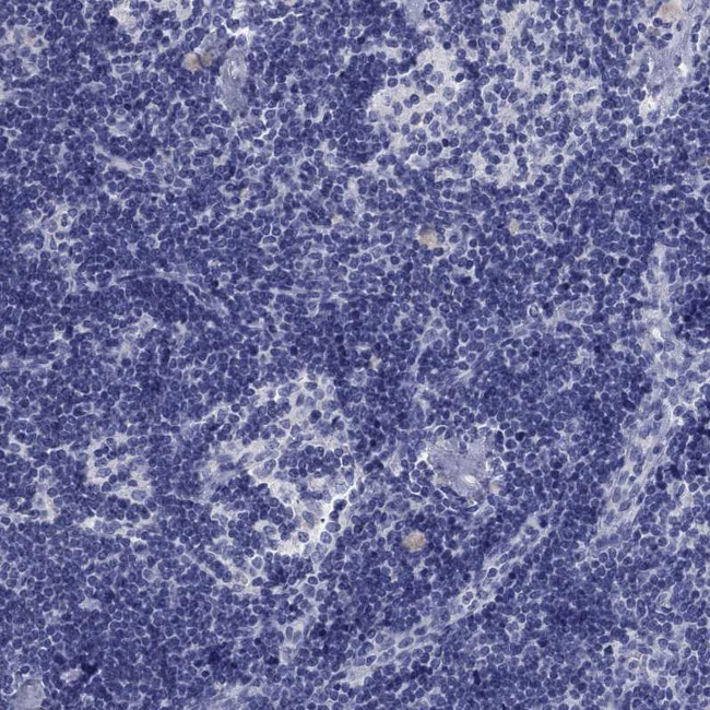 AOX1 Antibody in Immunohistochemistry (Paraffin) (IHC (P))