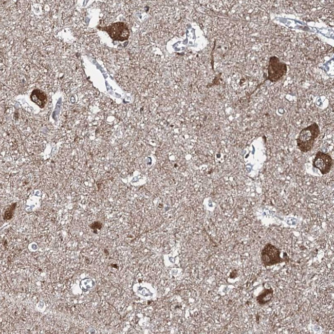 WHAMM Antibody in Immunohistochemistry (Paraffin) (IHC (P))