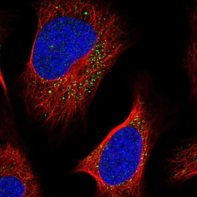 LIPT2 Antibody in Immunocytochemistry (ICC/IF)