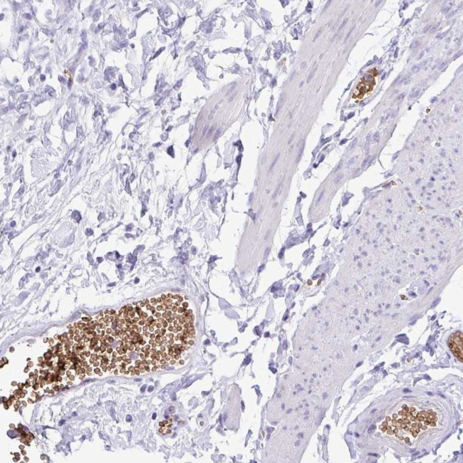 EPB42 Antibody in Immunohistochemistry (Paraffin) (IHC (P))