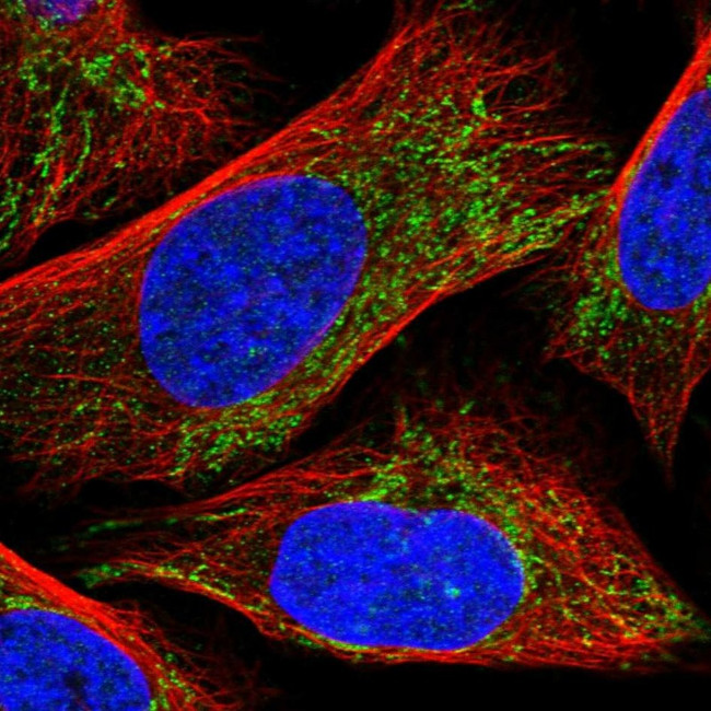 CLPX Antibody in Immunocytochemistry (ICC/IF)