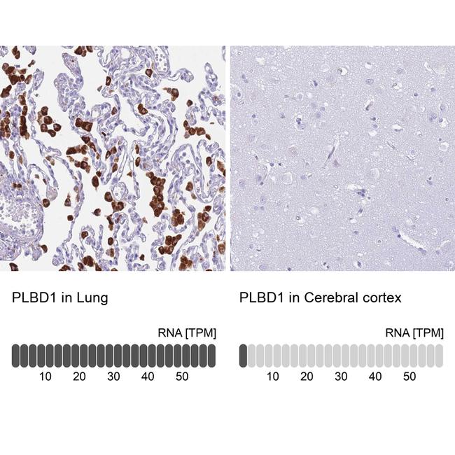 PLBD1 Antibody in Immunohistochemistry (IHC)