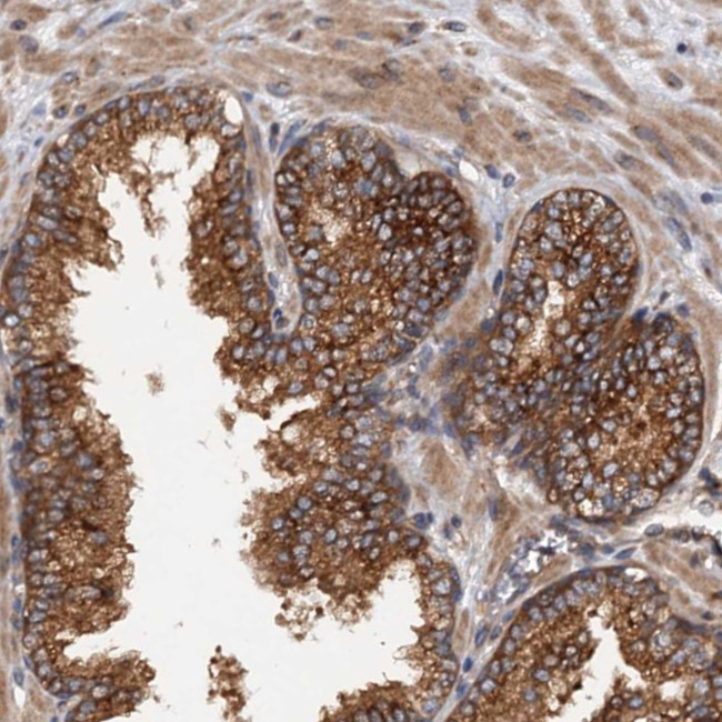 COG3 Antibody in Immunohistochemistry (Paraffin) (IHC (P))