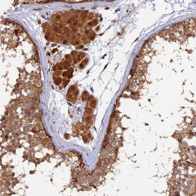 MNS1 Antibody in Immunohistochemistry (Paraffin) (IHC (P))