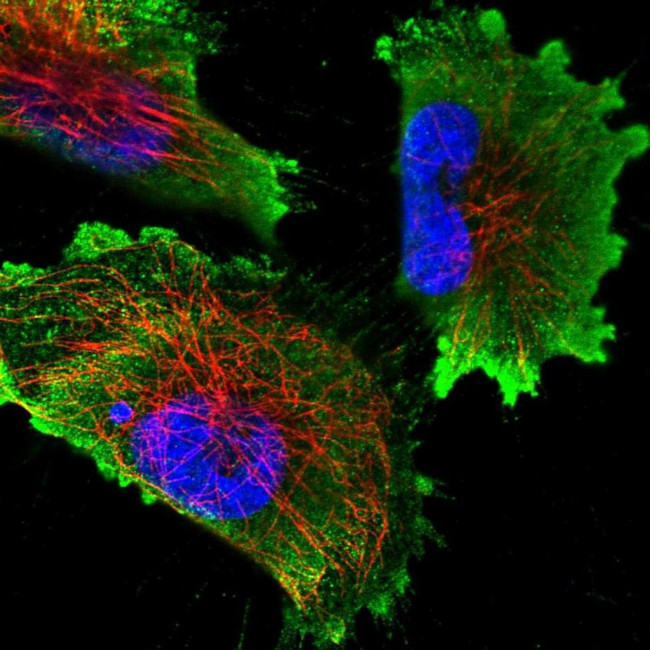 N6AMT2 Antibody in Immunocytochemistry (ICC/IF)