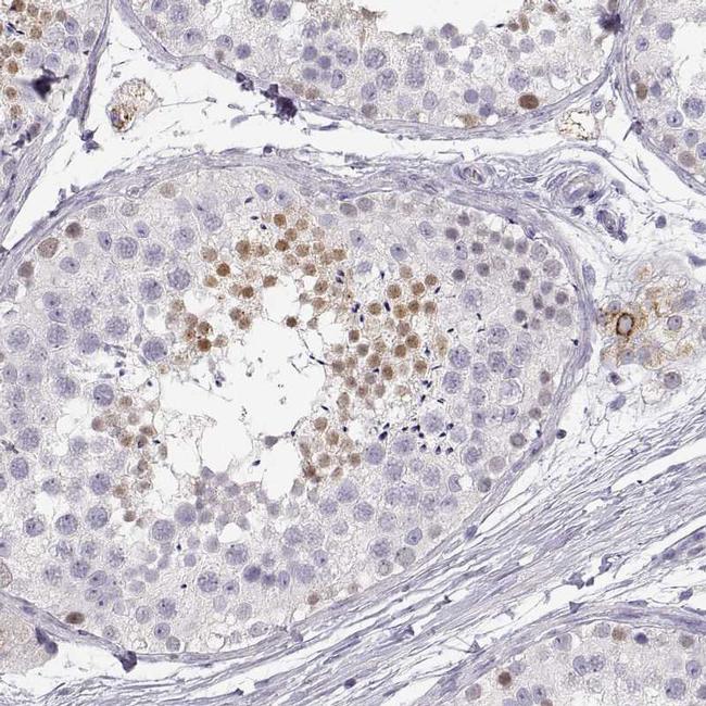 NUTM1 Antibody in Immunohistochemistry (IHC)