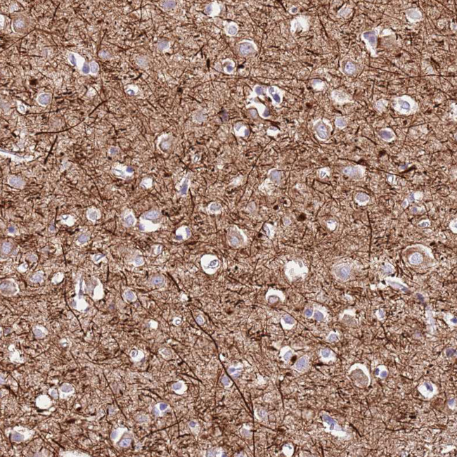 C2CD3 Antibody in Immunohistochemistry (Paraffin) (IHC (P))