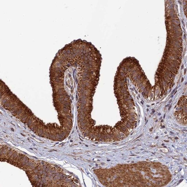 SPG21 Antibody in Immunohistochemistry (IHC)