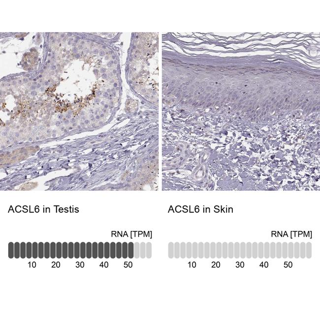 ACSL6 Antibody in Immunohistochemistry (IHC)