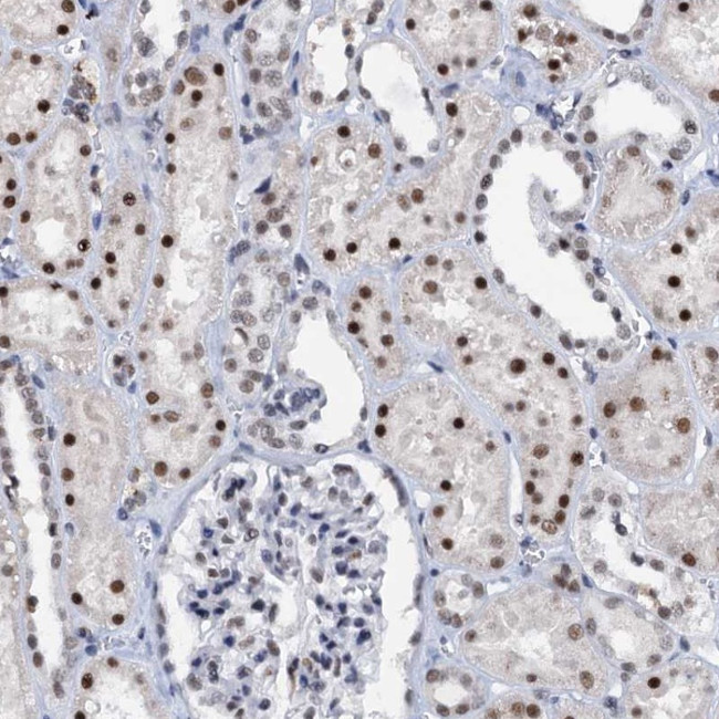 SNRPD1 Antibody in Immunohistochemistry (Paraffin) (IHC (P))