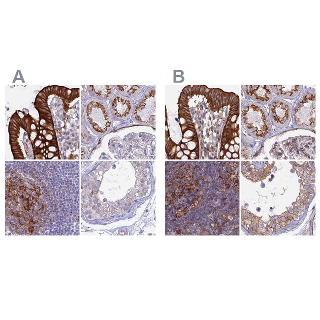 MYO5B Antibody in Immunohistochemistry (IHC)