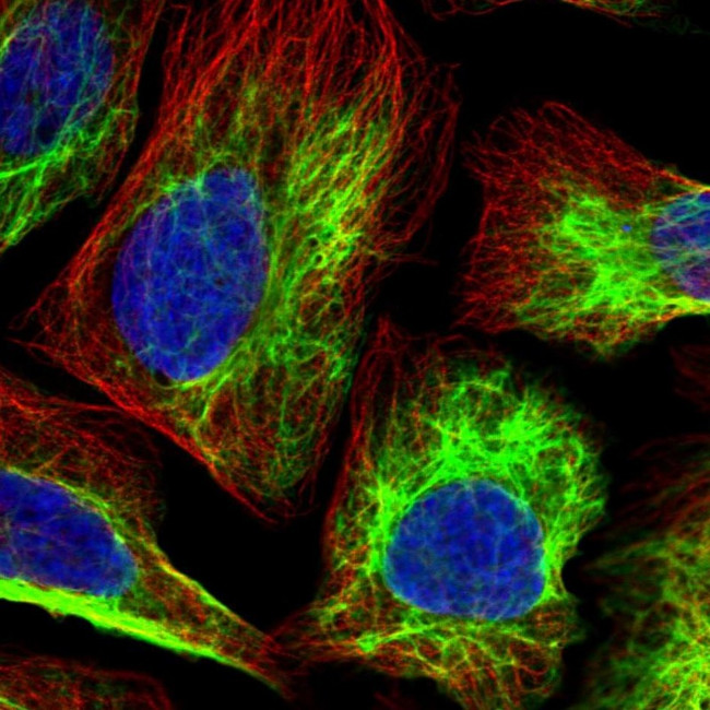 PGM2 Antibody in Immunocytochemistry (ICC/IF)