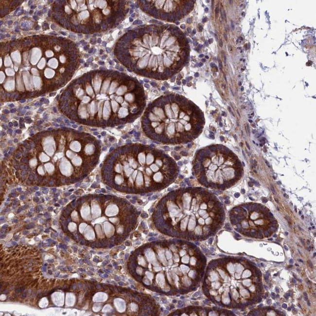 ACAD8 Antibody in Immunohistochemistry (Paraffin) (IHC (P))