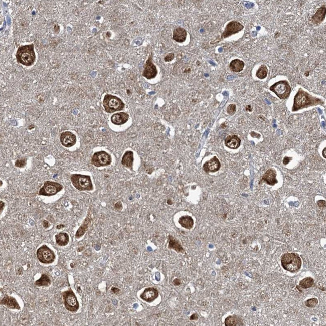 NCKAP1L Antibody in Immunohistochemistry (Paraffin) (IHC (P))