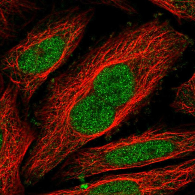 NIPBL Antibody in Immunocytochemistry (ICC/IF)